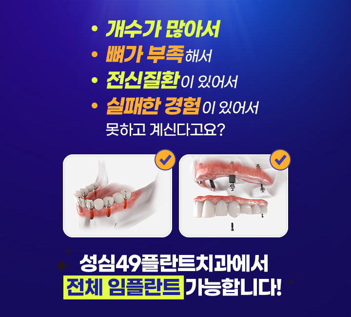 성심49플란트치과에서 전체 임플란트가 가능합니다!