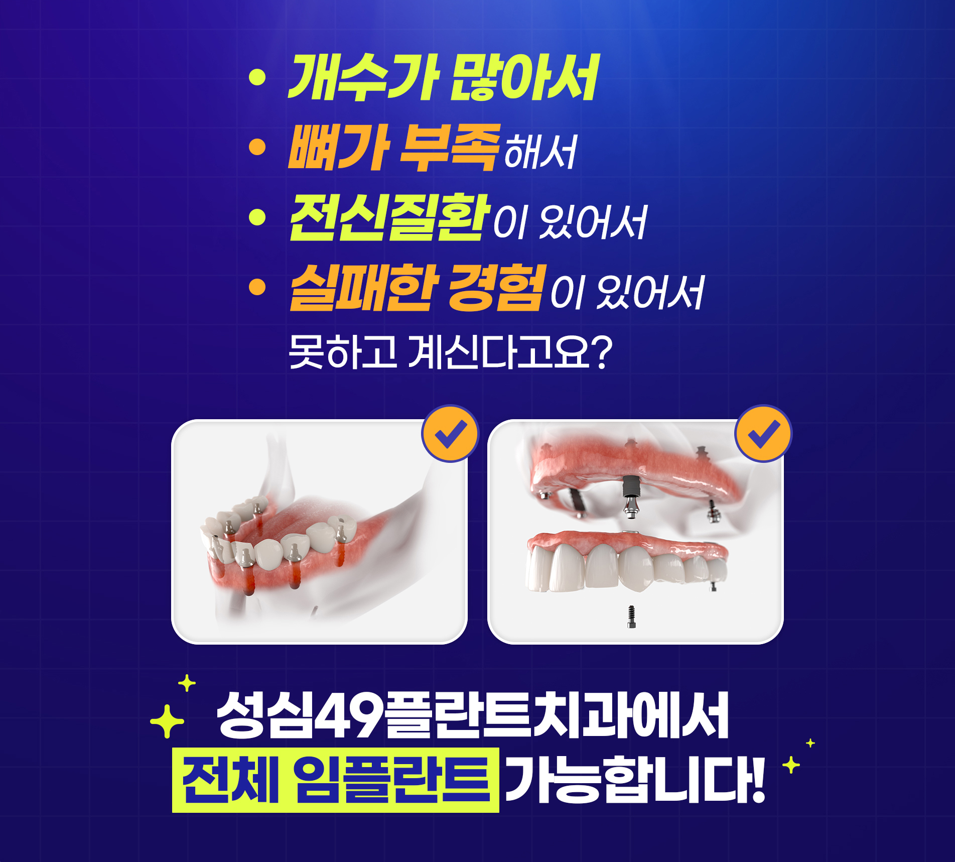 성심49플란트치과에서 전체 임플란트가 가능합니다!